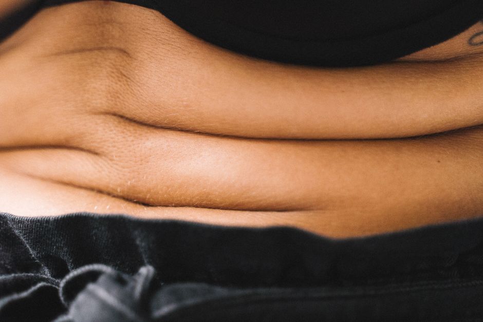 Skin Sagging illustration