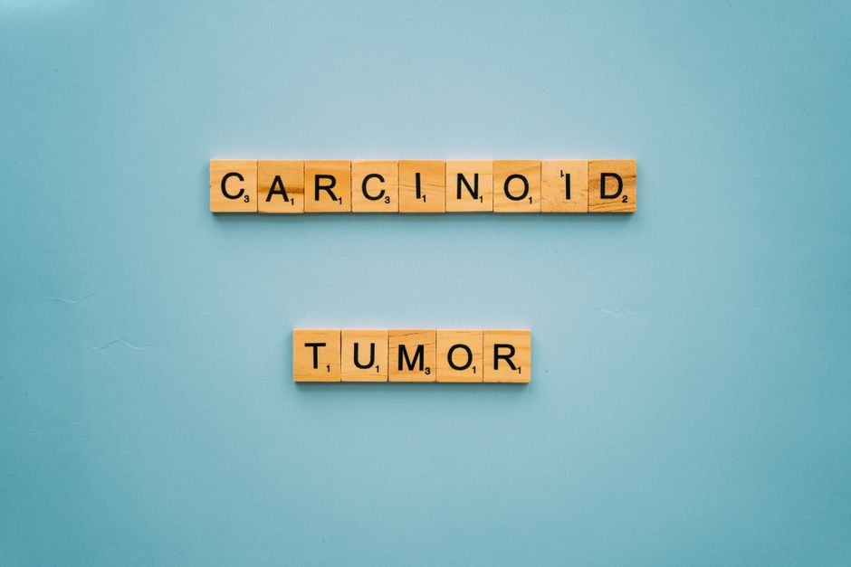 Thyroid Tumors illustration